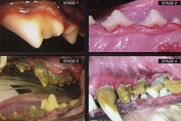 A periodontal disease 4-stage dental chart